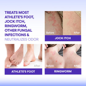 Detailed foamy lather of Hermon antifungal soap on skin