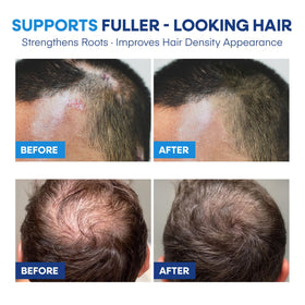 Hermon ingredients zinc pyrithione and salicylic acid emphasize active scalp care.