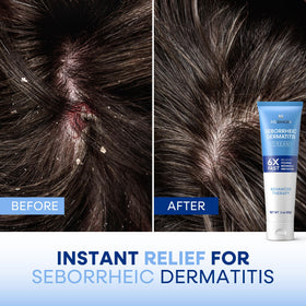 Hermon cream used on chest and body areas