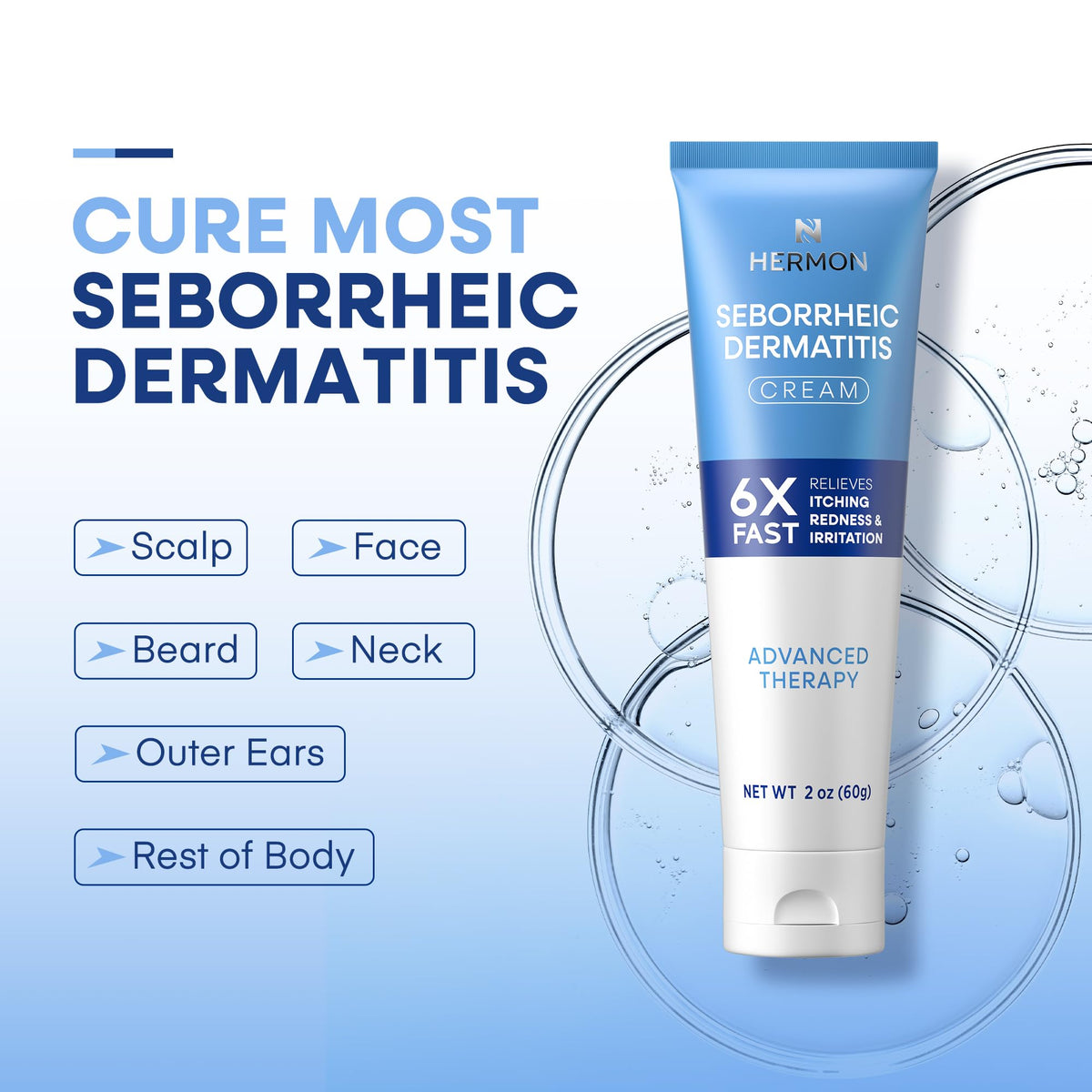 Hermon Seborrheic Dermatitis cream shown for facial use