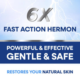 Hermon cream being applied to the scalp for soothing relief