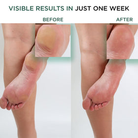 Hey Honey Walk the Walk Propolis Foot Cream texture close-up shows fast-absorbing moisture.