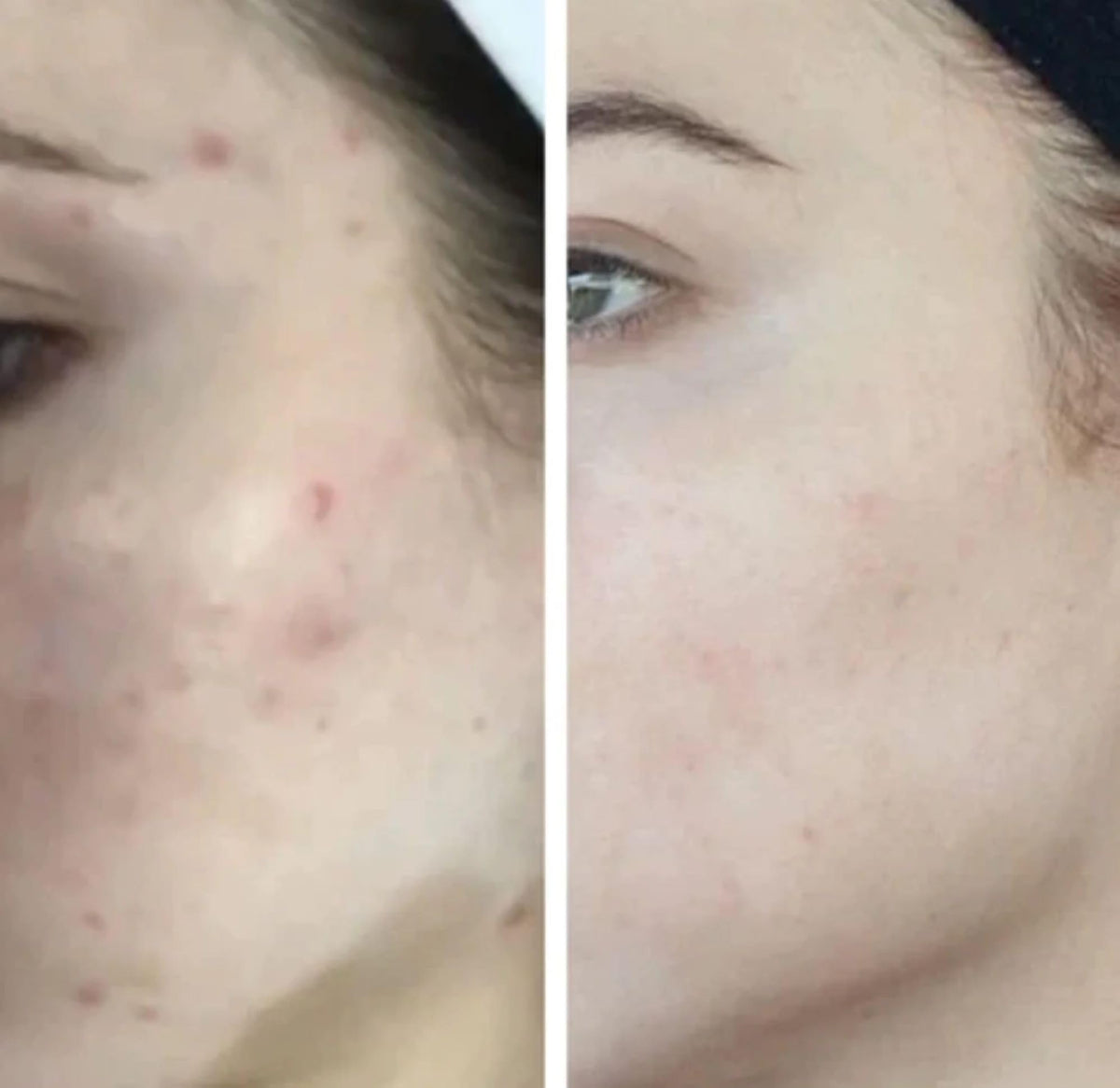 HigherDOSE Glow Serum massage close-up shows dewy glow