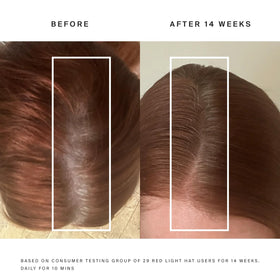 HigherDOSE red light hat close-up LED panel highlights targeted scalp therapy.