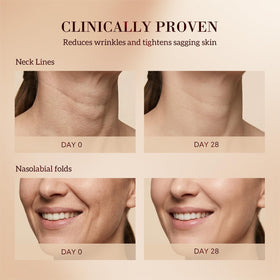 HKH Rock Rose extract illustration underscores skin-firming support.