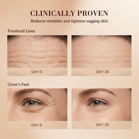 HKH serum capsule close-up highlights gentle, nourishing anti-aging formula.