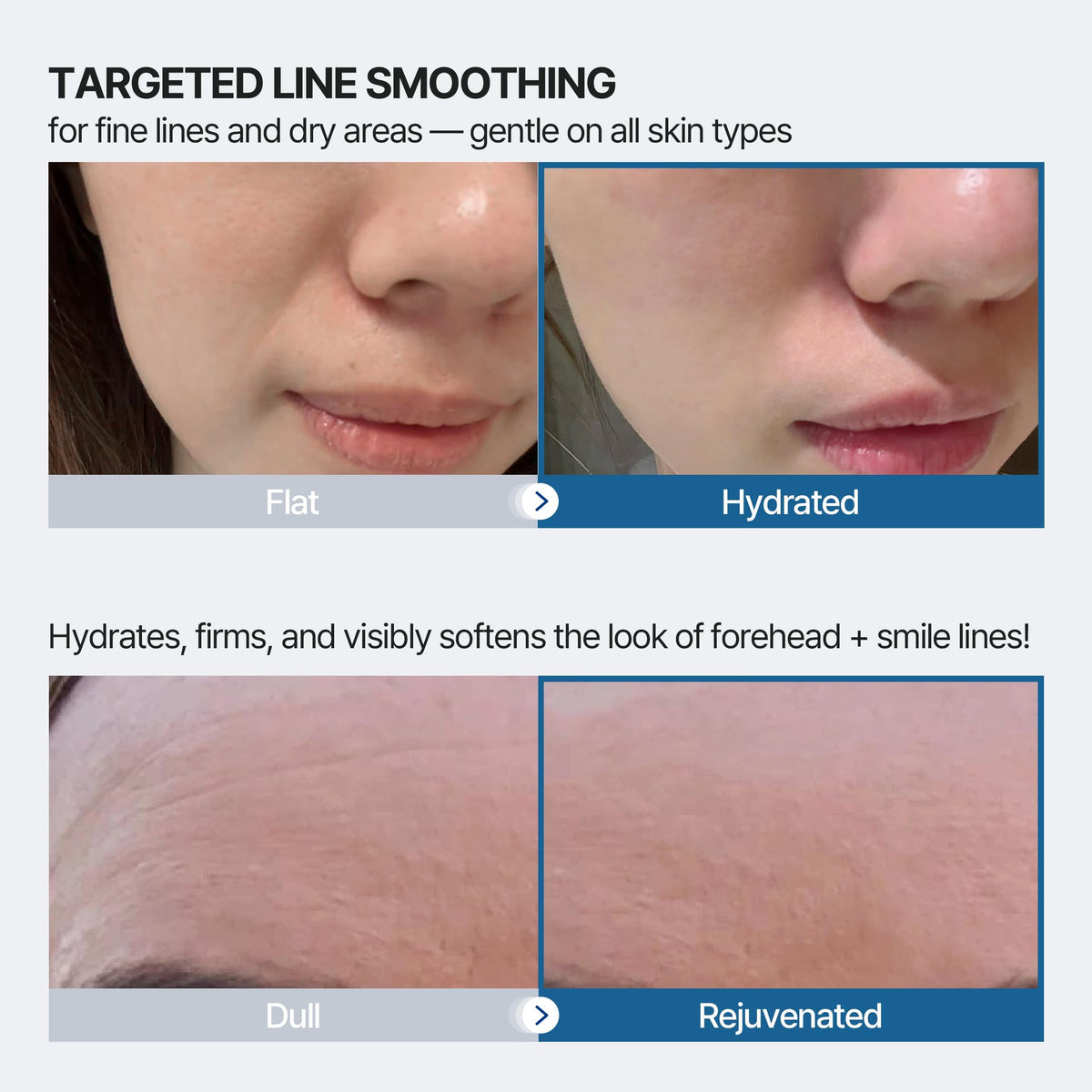 Honeydew Labs hydrogel technology patch adheres snugly to skin.