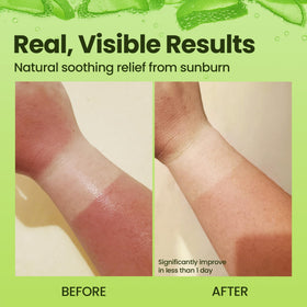 Honeyskin label and ingredients list highlighting clean botanical formula