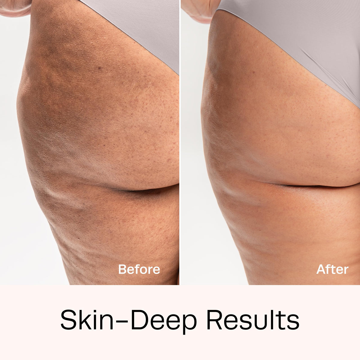 Hot Vita Retinol Roll-On texture-improvement area for smoother skin