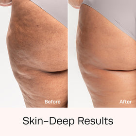 Hot Vita Retinol Roll-On texture-improvement area for smoother skin