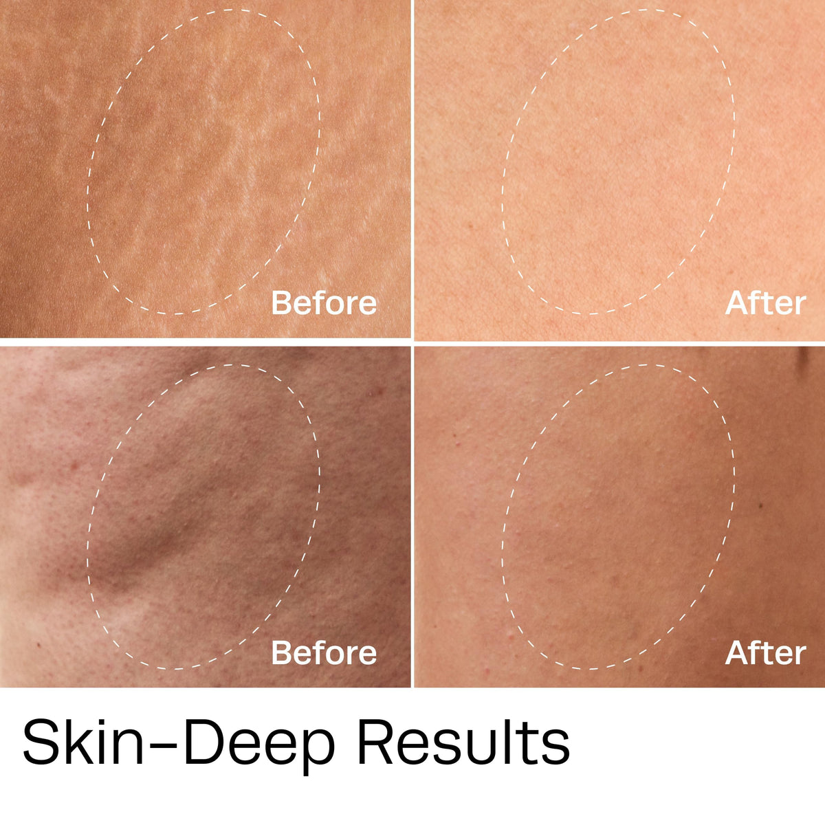 Hot Vita Vitamin C Oil body glow and radiance after application