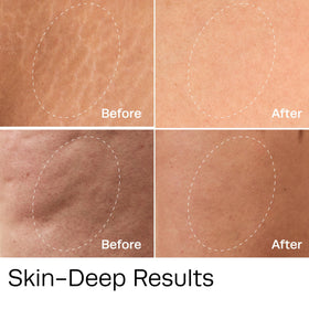 Hot Vita Vitamin C Oil body glow and radiance after application