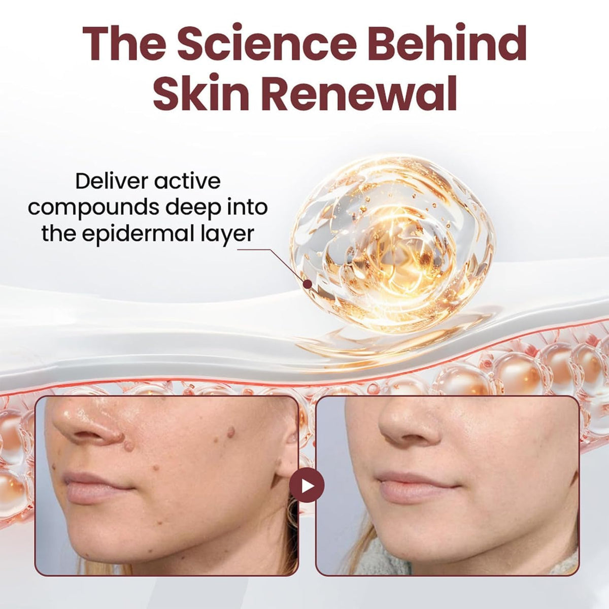 HTKINMI texture renewal softens rough patches for a smoother look.