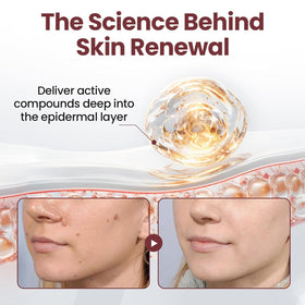 HTKINMI texture renewal softens rough patches for a smoother look.