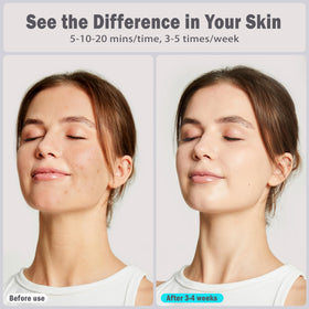 HWGIZP Purple Light Therapy Mask face supports collagen-friendly care and improved complexion