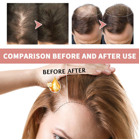 HXLANE Hair Ampoule Treatment packaging open, product ready to apply.