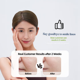 HYDROSMOOTH Patch Application On Face — easy placement around the mouth area for targeted care.