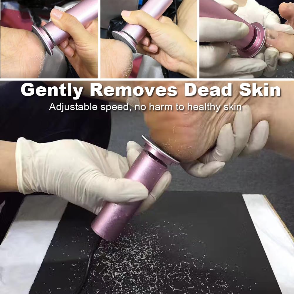 I·B·N G electric callus remover head in action shows targeted dead skin exfoliation