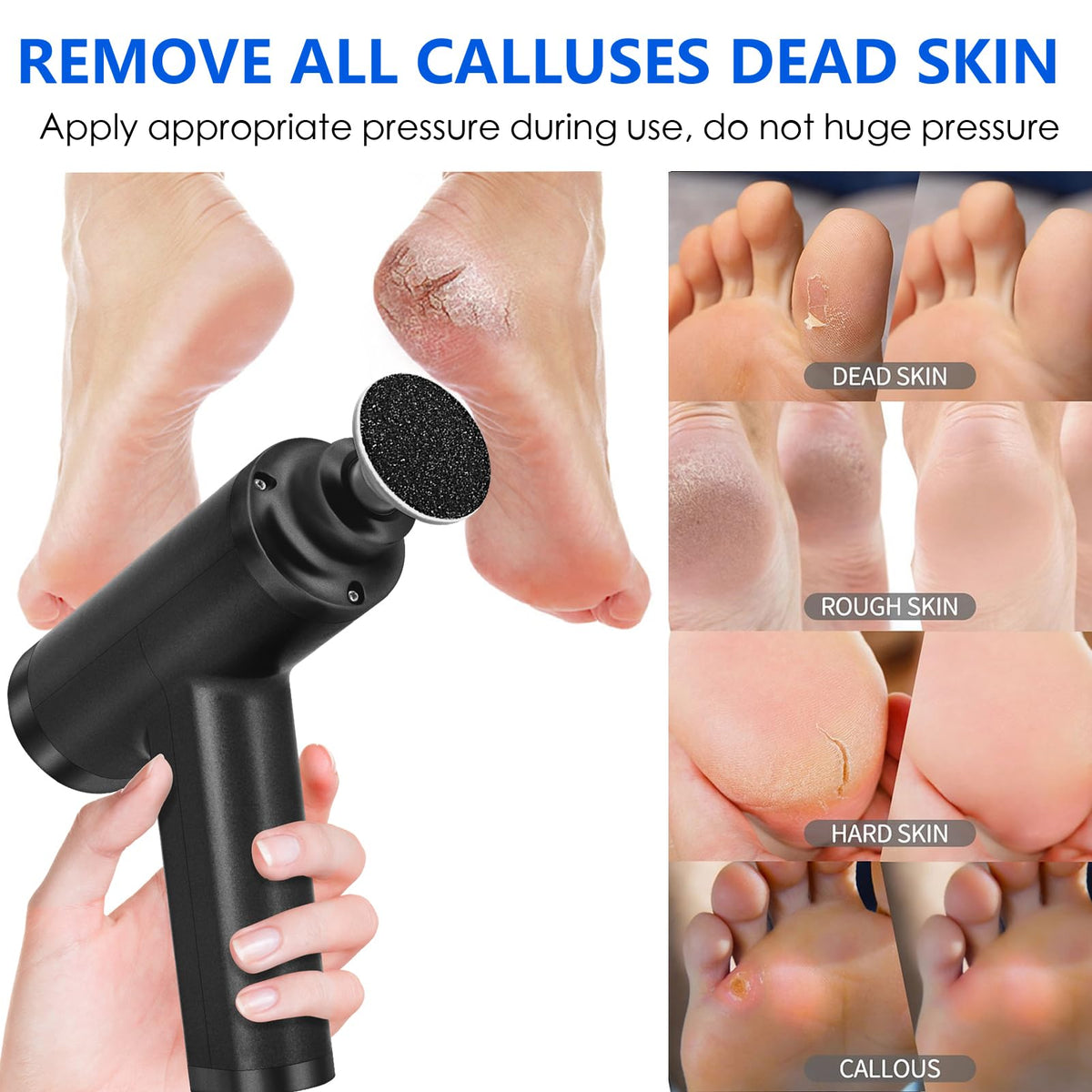 I·B·N G callus remover with small round head for tight spots.