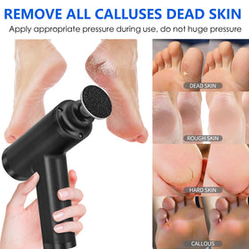 I·B·N G callus remover with small round head for tight spots.