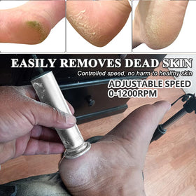 I·B·N G ibng upgraded foot file in use on feet for dead skin removal.