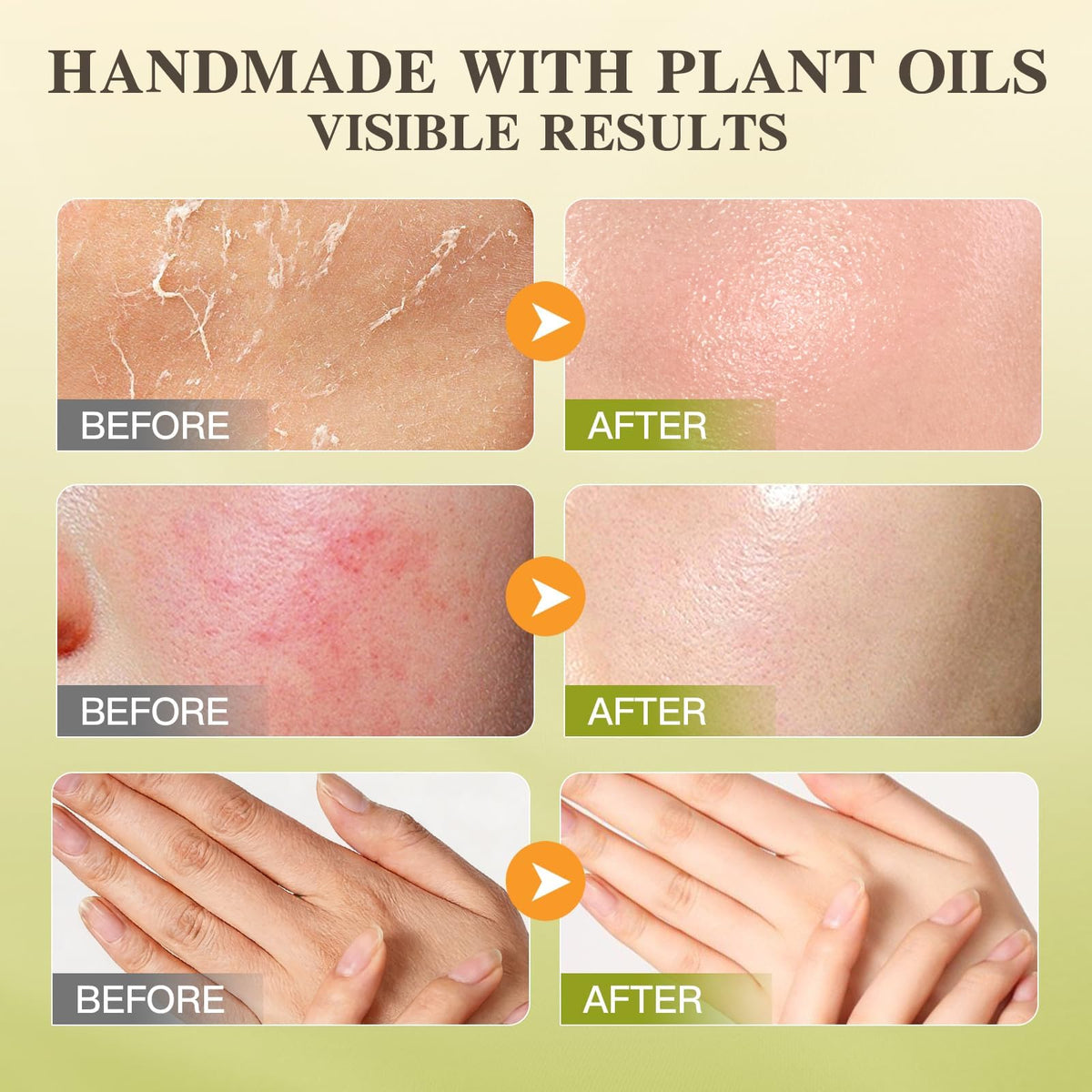 ICIKOL hands applying balm for daily moisture on dry skin