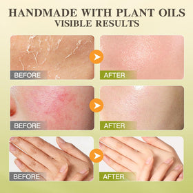 ICIKOL hands applying balm for daily moisture on dry skin