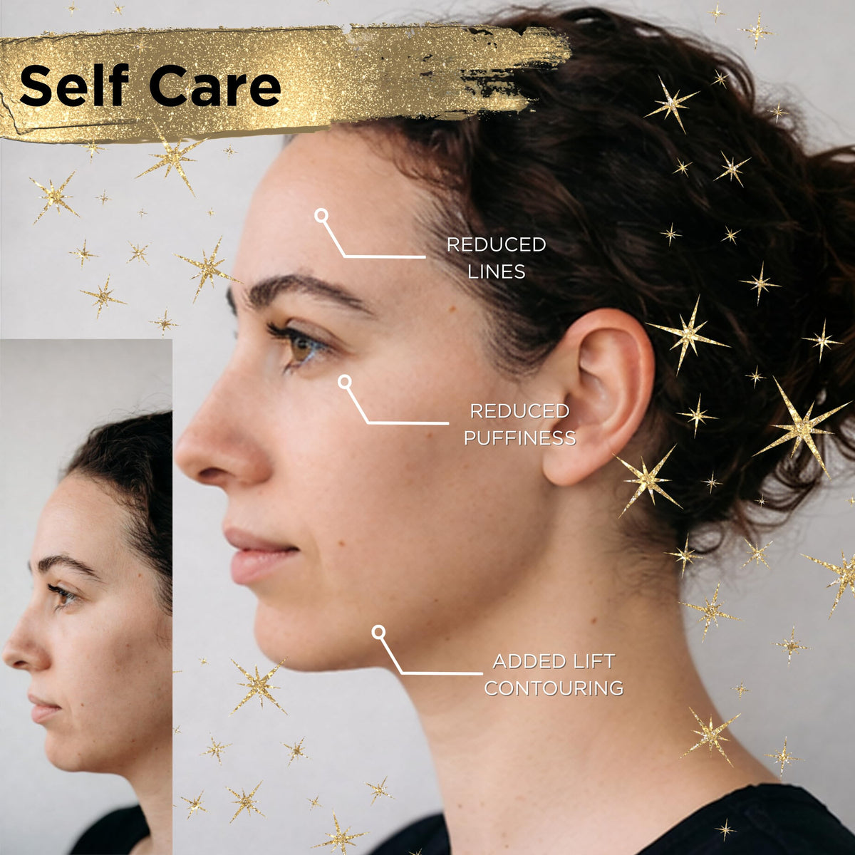 Icon Patch Lymphatic Contour Brush targets the neck for a lifted silhouette