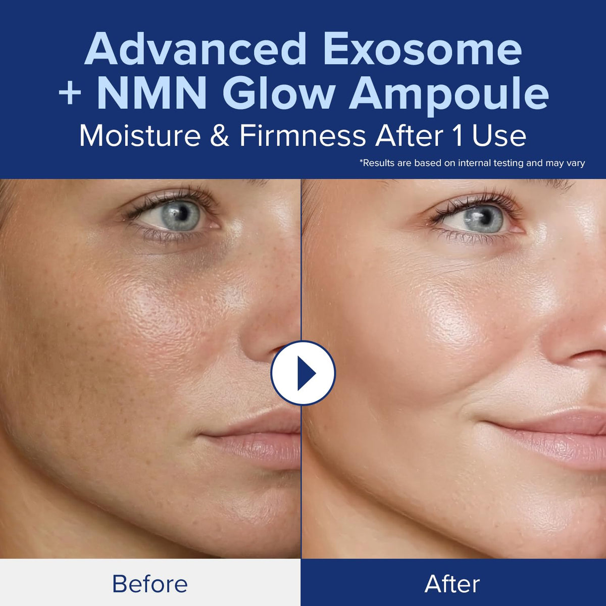 ID PLACOSMETICS EXO-V Plus Ampoule side view showing elegant dispenser.