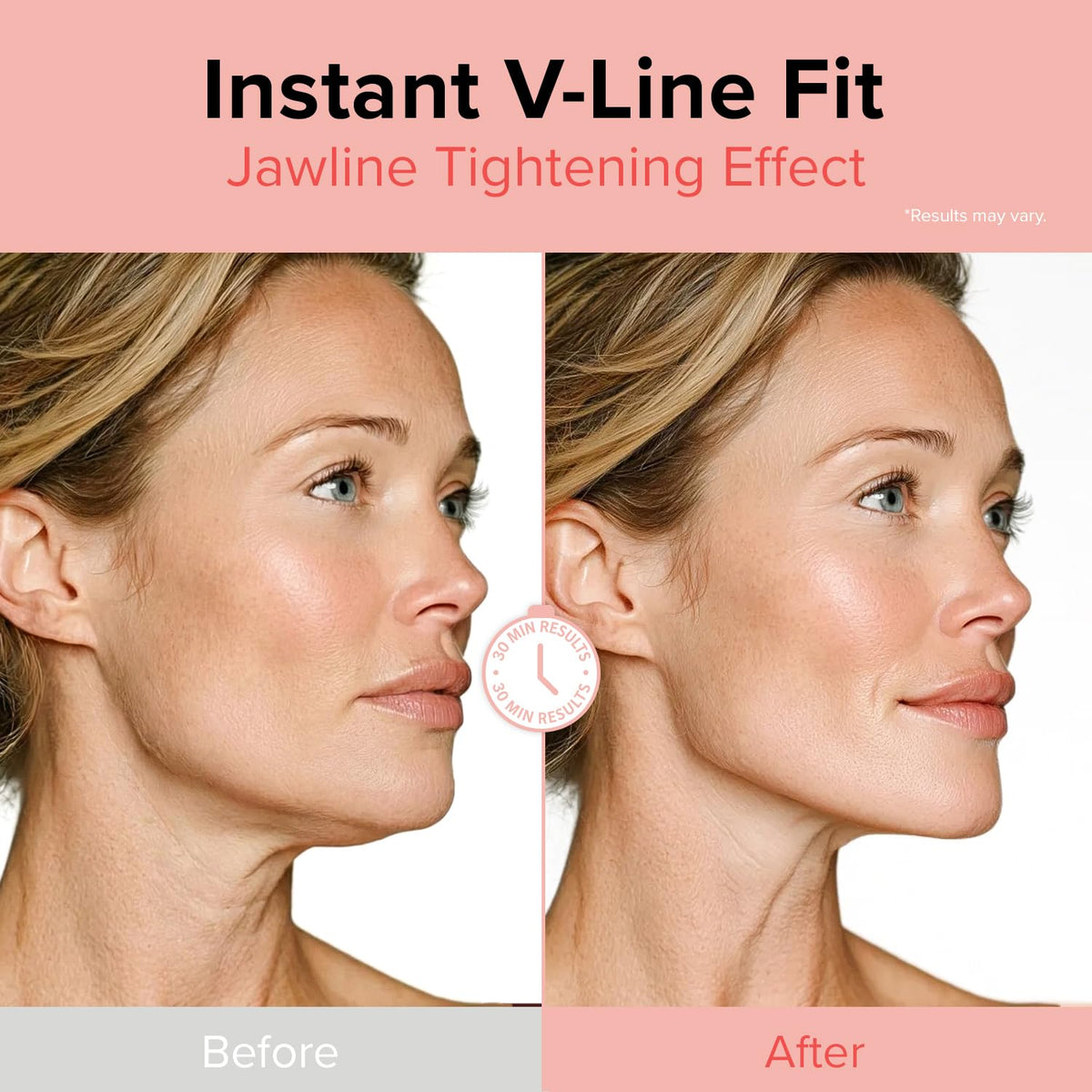 ID PLACOSMETICS Face Fit Minus Band V3 ear loop design for secure coverage.