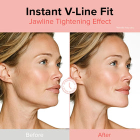 ID PLACOSMETICS Face Fit Minus Band V3 ear loop design for secure coverage.