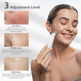 IeBilif 4 diamond and 4 plastic tips kit for various skin zones.