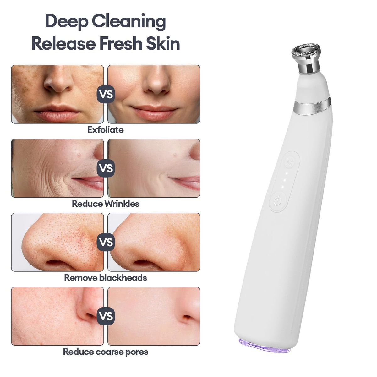 IeBilif home skincare kit—gift idea with durable warranty.