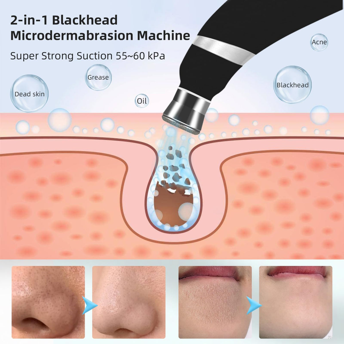 IeBilif machine with strong suction targets pores and deep cleansing.