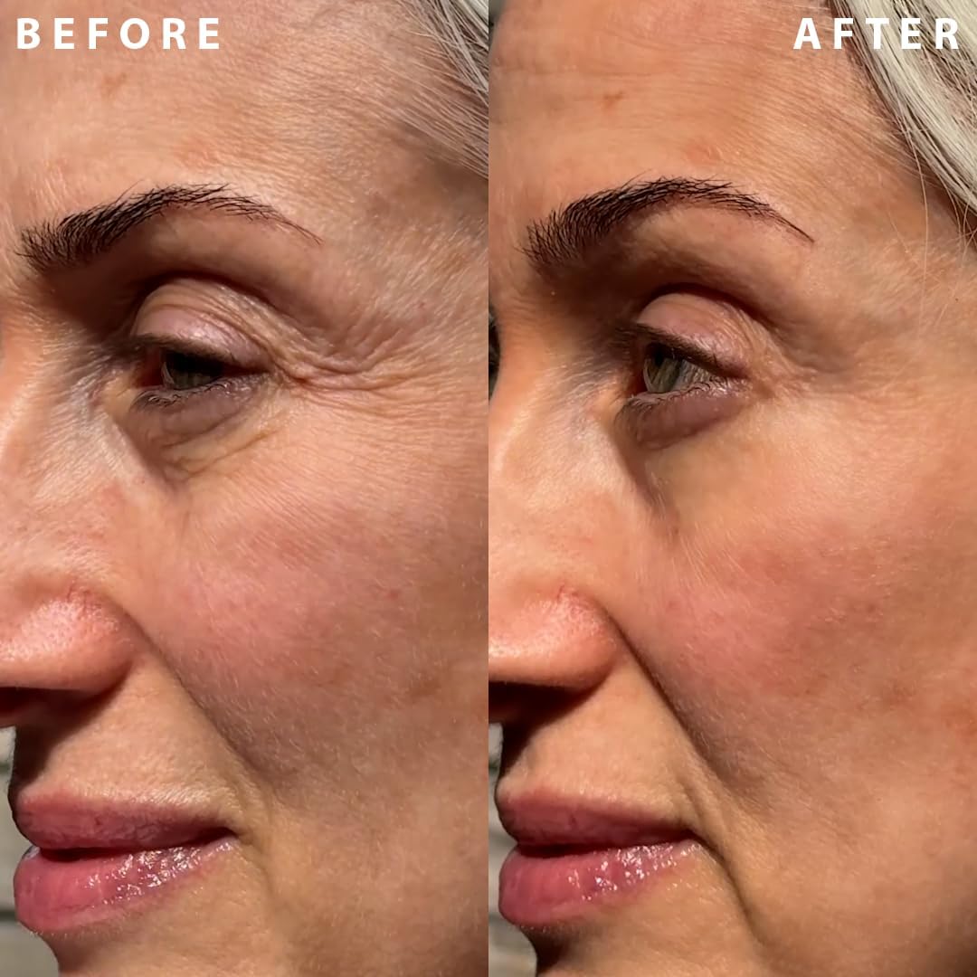 Tube applicator allows clean, precise layering for targeted wrinkle results.
