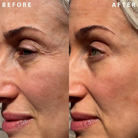 Tube applicator allows clean, precise layering for targeted wrinkle results.