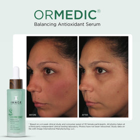 IMAGE Skincare ORMEDIC Balancing Serum featuring grape water and botanicals for nourishment.