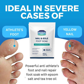 Imperial Feet athletes foot relief shown in use.