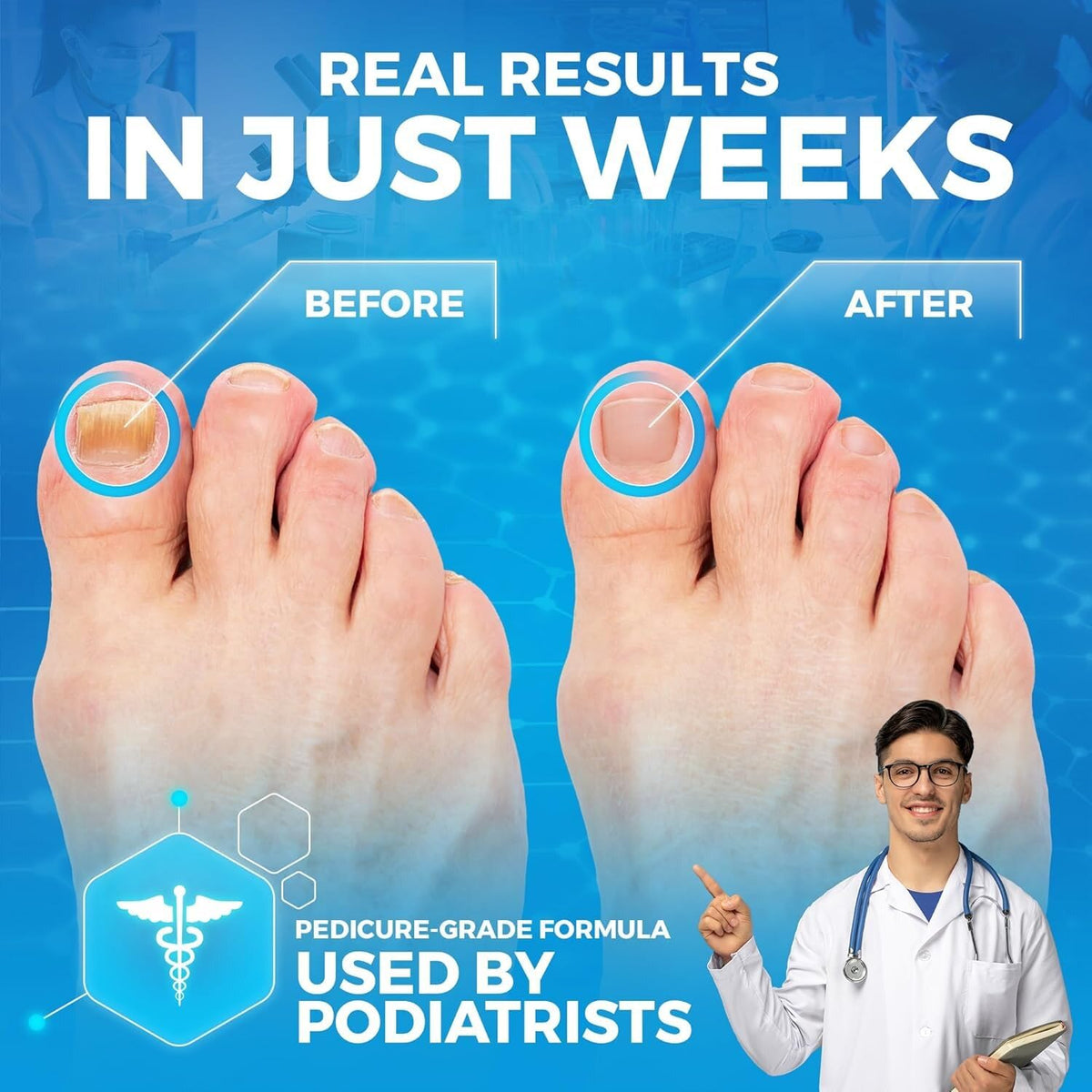 Imperial Feet tea tree oil visual emphasizes natural scent.