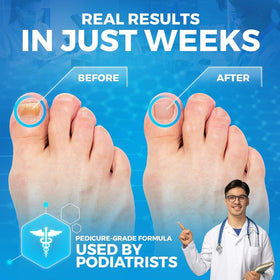 Imperial Feet tea tree oil visual emphasizes natural scent.