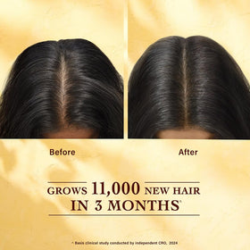 INDULEKHA Bringha after-shower application on damp hair promotes even distribution