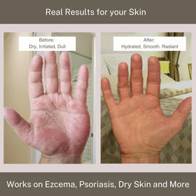 InfiniteAloe embossed jar lid signals premium, spa-grade experience.