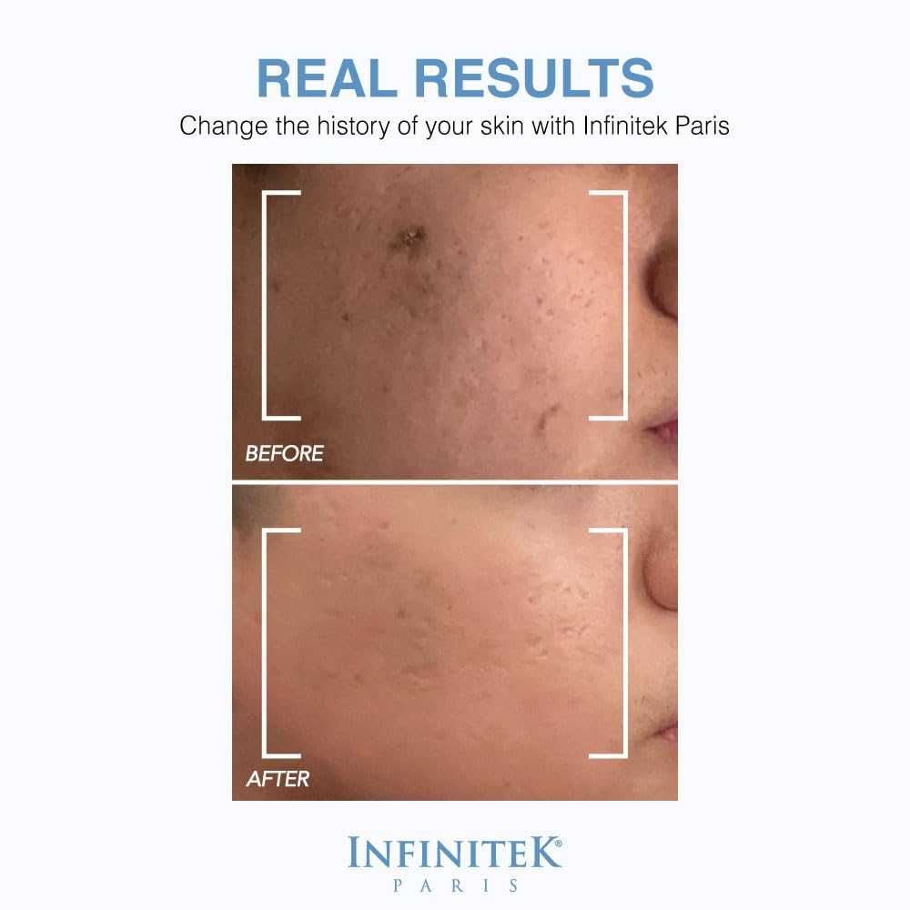 Infinitek Paris Hyaluronic Serum bottle with vitamin E suggests antioxidant protection.
