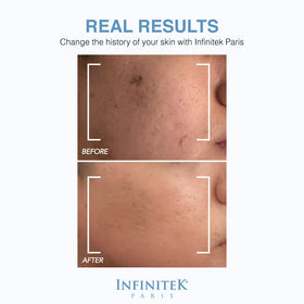Infinitek Paris Hyaluronic Serum bottle with vitamin E suggests antioxidant protection.