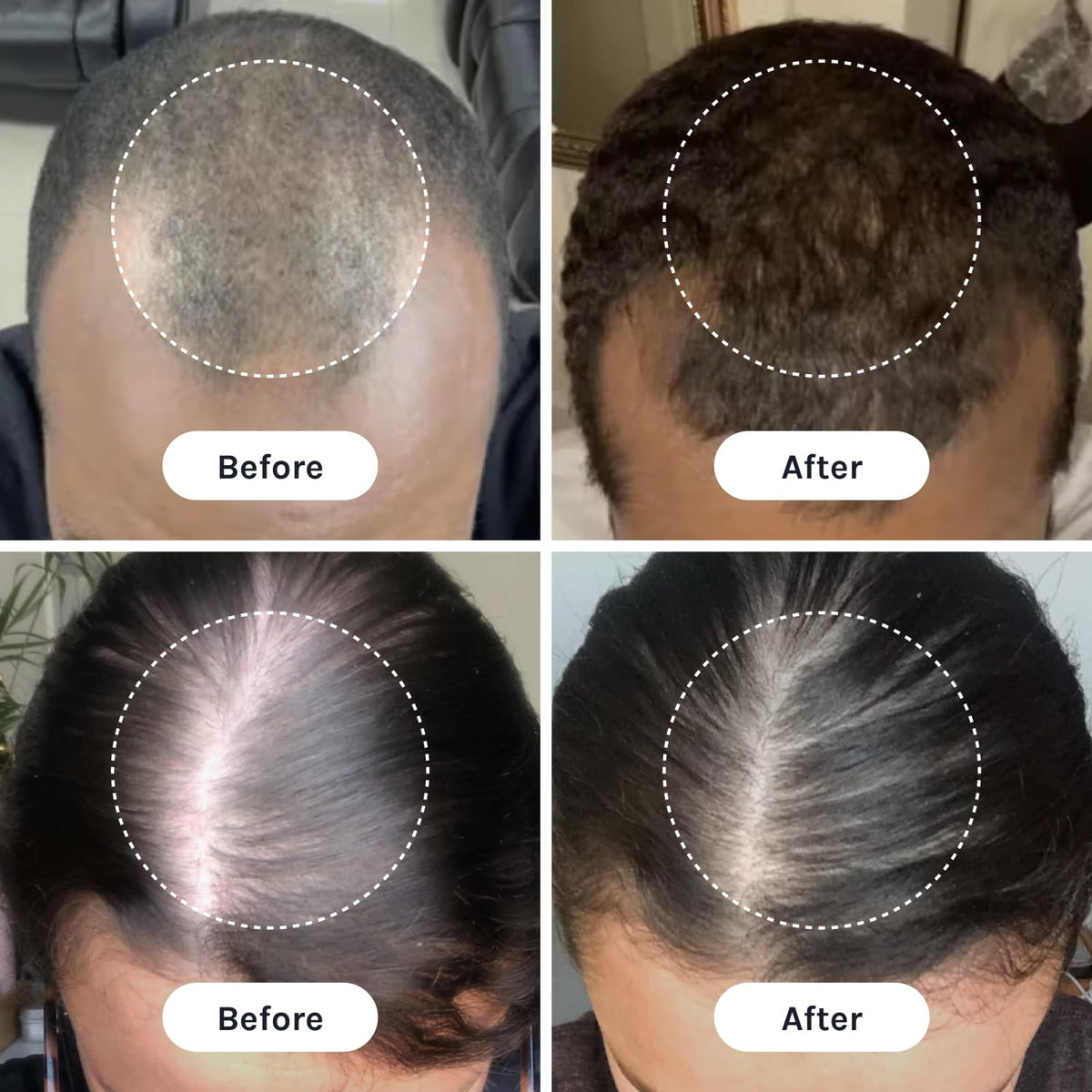 InfiniWell Duo Zn-Thymulin blend supports scalp renewal