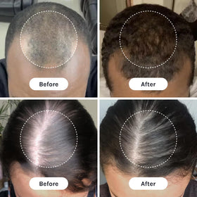 InfiniWell Duo Zn-Thymulin blend supports scalp renewal