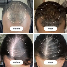InfiniWell scalp application glide demonstrating smooth serum spread