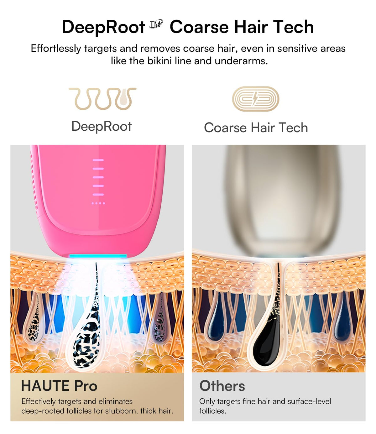 INIA Haute Pro body mode removes dense body hair efficiently.