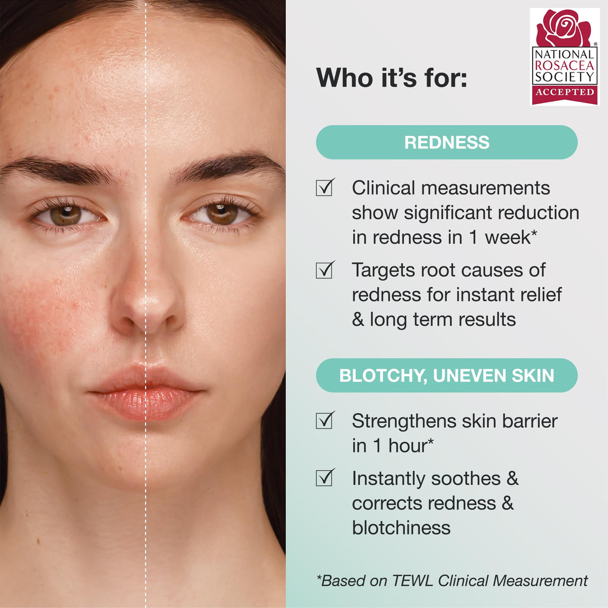 Innbeauty Project Calm the Red Down application on hand ready for daily use