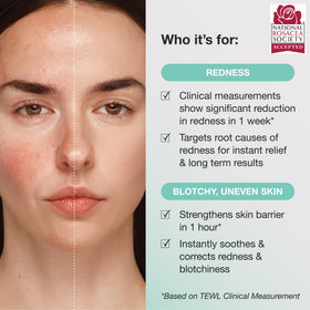 Innbeauty Project Calm the Red Down application on hand ready for daily use